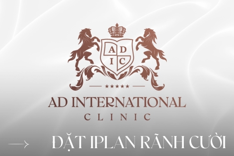 Đặt implant rãnh cười